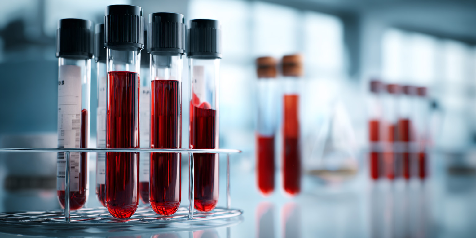 asna_editorial_medical_photography_blood_test_samples_in_labo_bf418bf6-cec1-4ac5-8ed9-7cba51163649_3.jpg asna_editorial_medical_photography_blood_test_samples_in_labo_bf418bf6-cec1-4ac5-8ed9-7cba51163649_3.jpg